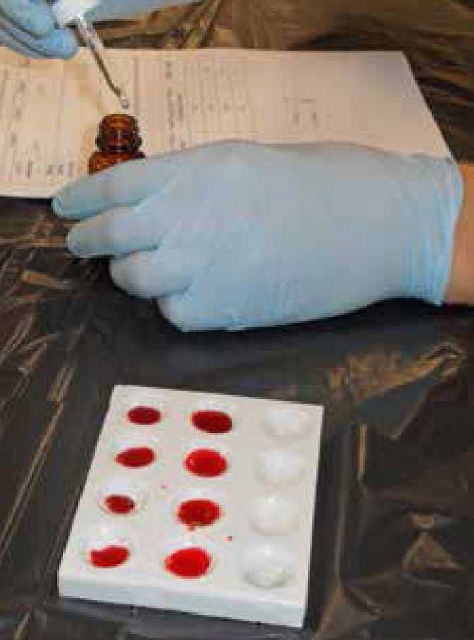 blood testing