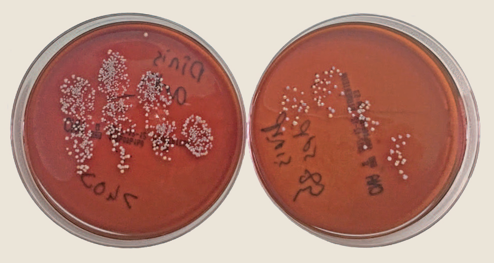 'Before' and 'after' agar plates for pupil 10
