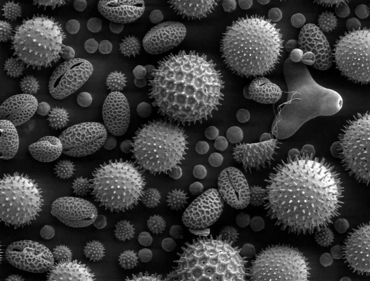 Pollen grains from a variety of common plants